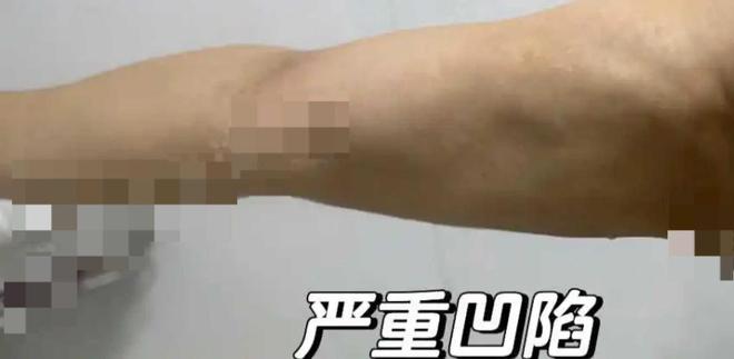 彩神vll官网艺星品牌成赞扬“大户”深圳艺星医疗美容病院被记者起底！(图6)
